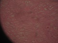 tecido_epitelial_estratificado1.jpg
