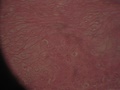 tecido_epitelial_estratificado2.jpg